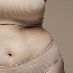 Tratamento Lipedema Uniplast